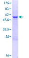 METAP1 Protein - 12.5% SDS-PAGE of human METAP1 stained with Coomassie Blue