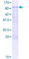 METAP2 Protein - 12.5% SDS-PAGE of human METAP2 stained with Coomassie Blue
