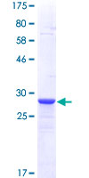 METRN / Meteorin Protein - 12.5% SDS-PAGE Stained with Coomassie Blue.