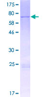METT11D1 Protein - 12.5% SDS-PAGE of human METTL17 stained with Coomassie Blue