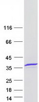 METTL1 Protein - Purified recombinant protein METTL1 was analyzed by SDS-PAGE gel and Coomassie Blue Staining