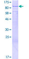 METTL13 / KIAA0859 Protein - 12.5% SDS-PAGE of human KIAA0859 stained with Coomassie Blue