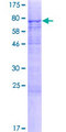 METTL14 Protein - 12.5% SDS-PAGE of human KIAA1627 stained with Coomassie Blue