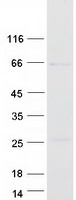 METTL14 Protein - Purified recombinant protein METTL14 was analyzed by SDS-PAGE gel and Coomassie Blue Staining