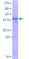 METTL15 / METT5D1 Protein - 12.5% SDS-PAGE of human METT5D1 stained with Coomassie Blue