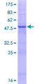 METTL15 / METT5D1 Protein - 12.5% SDS-PAGE of human METT5D1 stained with Coomassie Blue