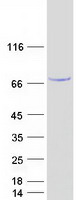 METTL16 / METT10D Protein - Purified recombinant protein METTL16 was analyzed by SDS-PAGE gel and Coomassie Blue Staining