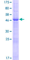 METTL21B / FAM119B Protein - 12.5% SDS-PAGE of human FAM119B stained with Coomassie Blue