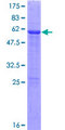 METTL2B Protein - 12.5% SDS-PAGE of human METTL2B stained with Coomassie Blue