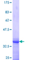 METTL2B Protein - 12.5% SDS-PAGE Stained with Coomassie Blue.