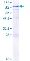 METTL3 Protein - 12.5% SDS-PAGE of human METTL3 stained with Coomassie Blue