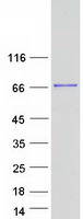 METTL3 Protein - Purified recombinant protein METTL3 was analyzed by SDS-PAGE gel and Coomassie Blue Staining