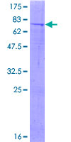 METTL4 Protein - 12.5% SDS-PAGE of human METTL4 stained with Coomassie Blue
