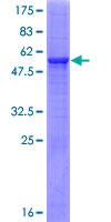 METTL6 Protein - 12.5% SDS-PAGE of human METTL6 stained with Coomassie Blue
