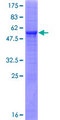 METTL6 Protein - 12.5% SDS-PAGE of human METTL6 stained with Coomassie Blue