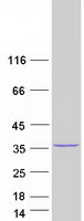 METTL6 Protein - Purified recombinant protein METTL6 was analyzed by SDS-PAGE gel and Coomassie Blue Staining