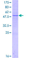 METTL7A Protein - 12.5% SDS-PAGE of human METTL7A stained with Coomassie Blue