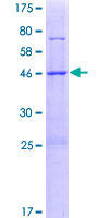 METTL7B Protein - 12.5% SDS-PAGE of human METTL7B stained with Coomassie Blue
