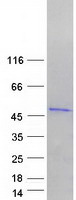 METTL8 Protein - Purified recombinant protein METTL8 was analyzed by SDS-PAGE gel and Coomassie Blue Staining