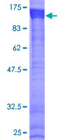 MEX3B / RKHD3 Protein - 12.5% SDS-PAGE of human RKHD3 stained with Coomassie Blue