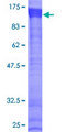 MEX3B / RKHD3 Protein - 12.5% SDS-PAGE of human RKHD3 stained with Coomassie Blue
