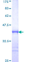 MEX3B / RKHD3 Protein - 12.5% SDS-PAGE Stained with Coomassie Blue.
