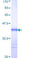 MEX3B / RKHD3 Protein - 12.5% SDS-PAGE Stained with Coomassie Blue.