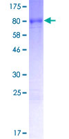 MEX3C Protein - 12.5% SDS-PAGE of human MEX3C stained with Coomassie Blue