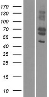 MFAP3L / NYD-Sp9 Protein - Western validation with an anti-DDK antibody * L: Control HEK293 lysate R: Over-expression lysate