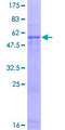 MFAP4 Protein - 12.5% SDS-PAGE of human MFAP4 stained with Coomassie Blue