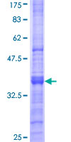 MFAP4 Protein - 12.5% SDS-PAGE Stained with Coomassie Blue