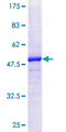 MFAP5 / MAGP2 Protein - 12.5% SDS-PAGE of human MFAP5 stained with Coomassie Blue