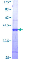 MFAP5 / MAGP2 Protein - 12.5% SDS-PAGE Stained with Coomassie Blue.