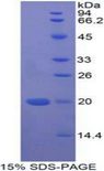 MFAP5 / MAGP2 Protein - Recombinant Microfibrillar Associated Protein 5 By SDS-PAGE