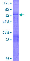 MFGE8 /Lactadherin Protein - 12.5% SDS-PAGE of human MFGE8 stained with Coomassie Blue