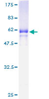 MFI2 / p97 Protein - 12.5% SDS-PAGE of human MFI2 stained with Coomassie Blue