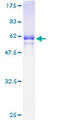 MFI2 / p97 Protein - 12.5% SDS-PAGE of human MFI2 stained with Coomassie Blue