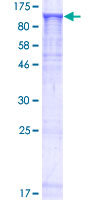 MFN1 Protein - 12.5% SDS-PAGE of human MFN1 stained with Coomassie Blue