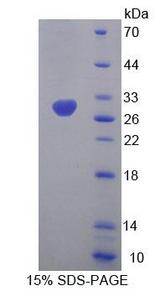 MFN1 Protein - Recombinant Mitofusin 1 By SDS-PAGE
