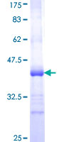 MFRP Protein - 12.5% SDS-PAGE Stained with Coomassie Blue.