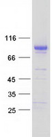 MFRP Protein - Purified recombinant protein MFRP was analyzed by SDS-PAGE gel and Coomassie Blue Staining