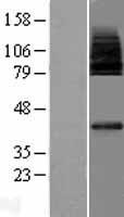 MFSD2A Protein - Western validation with an anti-DDK antibody * L: Control HEK293 lysate R: Over-expression lysate