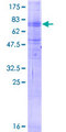 MFSD2A Protein - 12.5% SDS-PAGE of human MFSD2 stained with Coomassie Blue