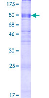 MFSD6 Protein - 12.5% SDS-PAGE of human FLJ20160 stained with Coomassie Blue