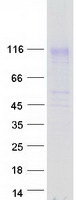 MFSD6 Protein - Purified recombinant protein MFSD6 was analyzed by SDS-PAGE gel and Coomassie Blue Staining