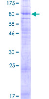 MFSD6L Protein - 12.5% SDS-PAGE of human FLJ35773 stained with Coomassie Blue