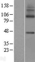 MFSD7 / MYL5 Protein - Western validation with an anti-DDK antibody * L: Control HEK293 lysate R: Over-expression lysate