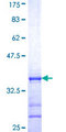 MFSD7 / MYL5 Protein - 12.5% SDS-PAGE Stained with Coomassie Blue.