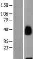 MFSD8 Protein - Western validation with an anti-DDK antibody * L: Control HEK293 lysate R: Over-expression lysate