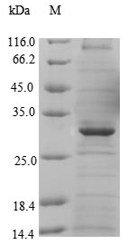 MFSD8 Protein - (Tris-Glycine gel) Discontinuous SDS-PAGE (reduced) with 5% enrichment gel and 15% separation gel.